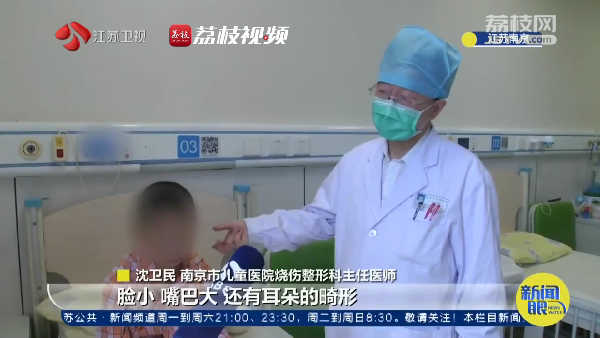 重塑笑颜！40名面部畸形患儿在南京迎来蜕变