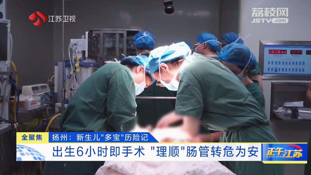 扬州：新生儿“多宝”历险记 出生6小时即手术 “理顺”肠管转危为安